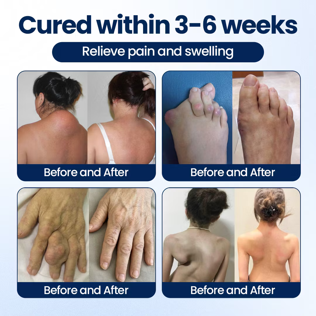 Auora ArthriNAD+ Pro Advanced Joint Recovery Cream