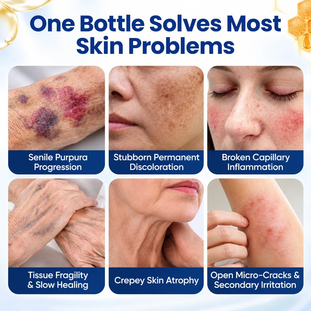 Auora VenoRescue Bee Venom Bruise & Skin Recovery Spray