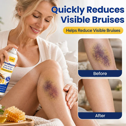 Auora VenoRescue Bee Venom Bruise & Skin Recovery Spray