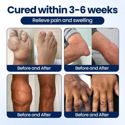 Auora ArthriNAD+ Pro Advanced Joint Recovery Cream