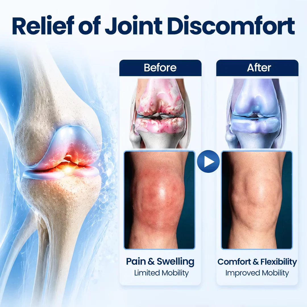 Auora ArthriNAD+ Pro Advanced Joint Recovery Cream