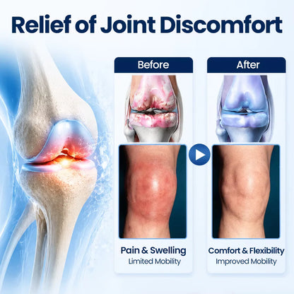 Auora ArthriNAD+ Pro Advanced Joint Recovery Cream